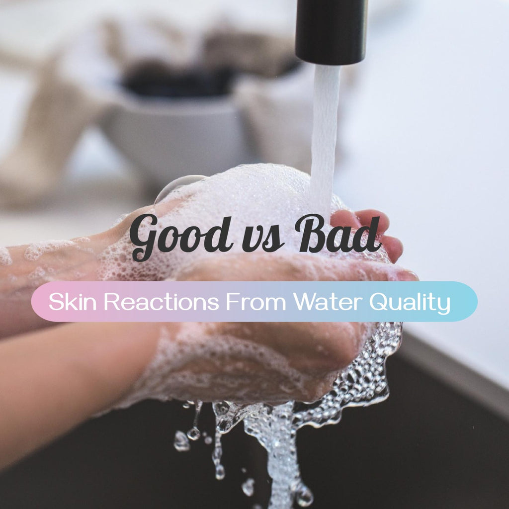 Possible skin reactions from good vs bad water quality